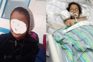 عملية جراحية تدخل طفلة في غيبوبة