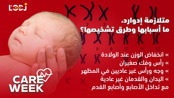 Care Week : رُضَّع يموتون بعد أسبوعٍ واحد، متلازمة إدوارد، ما أسبابها وطرق تشخيصها ؟ Care Week : رُضَّع يموتون بعد أسبوعٍ واحد، متلازمة إدوارد، ما أسبابها وطرق تشخيصها ؟