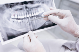 سلا.. توقيف شبكة إجرامية تنشط في طب وجراحة الأسنان بدون ترخيص سلا.. توقيف شبكة إجرامية تنشط في طب وجراحة الأسنان بدون ترخيص