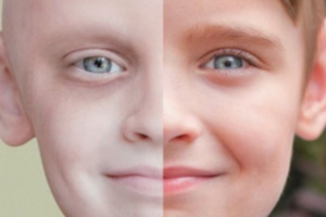 لأول مرة معالجة السرطان بالنووي لأول مرة معالجة السرطان بالنووي