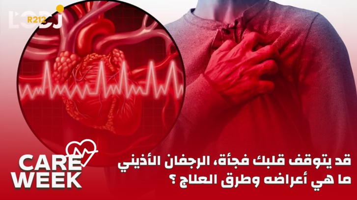 Care Week : قد يتوقف قلبك فجأة، الرجفان الأذيني، ما هي أعراضه وطرق العلاج؟ Care Week : قد يتوقف قلبك فجأة، الرجفان الأذيني، ما هي أعراضه وطرق العلاج؟