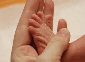 وصفات طبيعية تخلص رضيعك من جفاف الجلد وتشققه