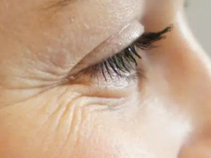 وصفات طبيعية لمحاربة التجاعيد وصفات طبيعية لمحاربة التجاعيد