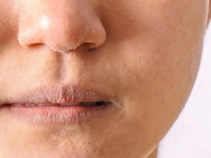 نصائح فعّالة للتخلص من جفاف البشرة نصائح فعّالة للتخلص من جفاف البشرة