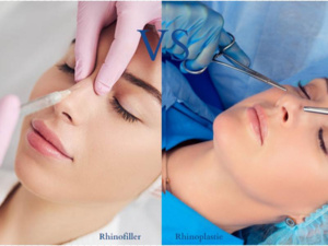 كل ما تحتاج معرفته عن حقن الفيلر: التوقعات والمخاطر والفوائد كل ما تحتاج معرفته عن حقن الفيلر: التوقعات والمخاطر والفوائد