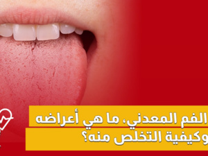 الفم المعدني، ما هي أعراضه وكيفية التخلص منه؟ الفم المعدني، ما هي أعراضه وكيفية التخلص منه؟