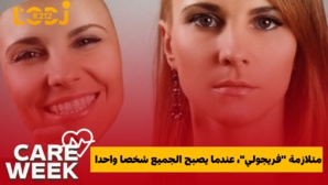 متلازمة "فريجولي"، عندما يصبح الجميع شخصا واحدا متلازمة "فريجولي"، عندما يصبح الجميع شخصا واحدا