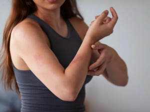 جدري القرود: كيفية الوقاية والتعامل مع المرض جدري القرود: كيفية الوقاية والتعامل مع المرض