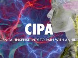 "سيبا" : متلازمة نادرة تمنع الشعور بالألم والبكاء "سيبا" : متلازمة نادرة تمنع الشعور بالألم والبكاء