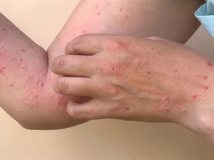 فيروس جديد يثير القلق في الصين، ما هي خطورته؟ فيروس جديد يثير القلق في الصين، ما هي خطورته؟