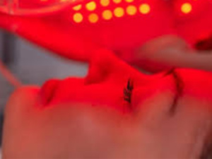 "ضوء "ليد": ثورة في علاج مشاكل البشرة المُستعصية بطرق آمنة وفعالة" "ضوء "ليد": ثورة في علاج مشاكل البشرة المُستعصية بطرق آمنة وفعالة"