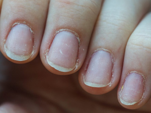 خطوات بسيطة لتقوية الأظافر وحمايتها من التكسر خطوات بسيطة لتقوية الأظافر وحمايتها من التكسر