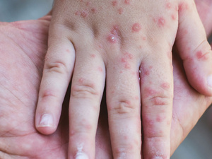 فاس: حملة واسعة لتلقيح التلاميذ ضد داء «بوحمرون» تستمر في مختلف المؤسسات التعليمية فاس: حملة واسعة لتلقيح التلاميذ ضد داء «بوحمرون» تستمر في مختلف المؤسسات التعليمية