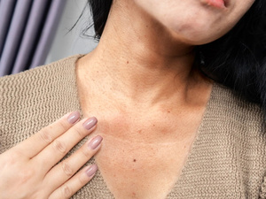 كيف يمكن الوقاية من ترهل جلد الرقبة؟ نصائح من طبيبة جلدية كيف يمكن الوقاية من ترهل جلد الرقبة؟ نصائح من طبيبة جلدية