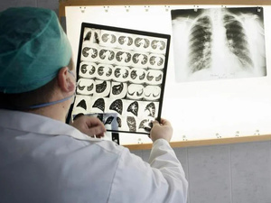 الحليب غير المبستر وداء السل: بين الحقائق العلمية والتهويل الإعلامي الحليب غير المبستر وداء السل: بين الحقائق العلمية والتهويل الإعلامي