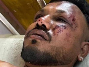 الناجي الوحيد من حادث تحطم طائرة «إير إنديا»: قصة صمود وسط الحطام