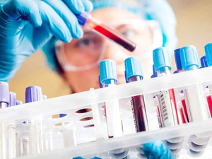 المغرب يحقق تقدماً في مكافحة السيدا رغم تحديات التمويل والوصم الاجتماعي المغرب يحقق تقدماً في مكافحة السيدا رغم تحديات التمويل والوصم الاجتماعي