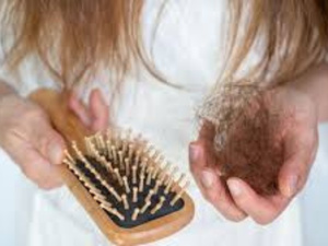 نقص الفيتامينات والمعادن وتأثيره على تساقط الشعر: الأسباب والحلول نقص الفيتامينات والمعادن وتأثيره على تساقط الشعر: الأسباب والحلول