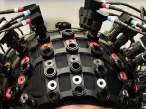 بدون تدخل جراحي.. تطوير خوذة فوق صوتية لتحفيز الدماغ بدون تدخل جراحي.. تطوير خوذة فوق صوتية لتحفيز الدماغ