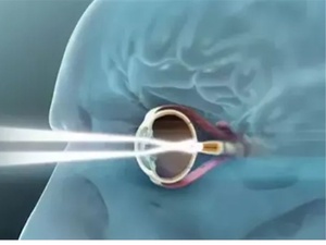 عين إلكترونية جديدة تمنح فاقدي البصر القدرة على القراءة مجددًا عين إلكترونية جديدة تمنح فاقدي البصر القدرة على القراءة مجددًا