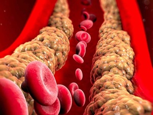 نصائح مثبتة علميًا لتقليل الكوليسترول وتحسين القلب بلا أدوية