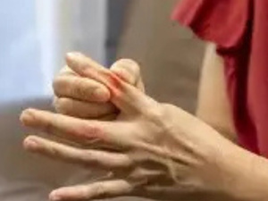 نصائح صحية: هذه الأغذية قد تزيد خطر الإصابة بالنقرس نصائح صحية: هذه الأغذية قد تزيد خطر الإصابة بالنقرس