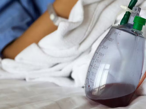 الدرين من نوع ريدون: دوره وكيفية العناية به بعد العمليات الجراحية