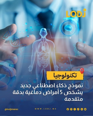 نموذج ذكاء اصطناعي جديد يشخص أمراض الدماغ بدقة متقدمة نموذج ذكاء اصطناعي جديد يشخص أمراض الدماغ بدقة متقدمة