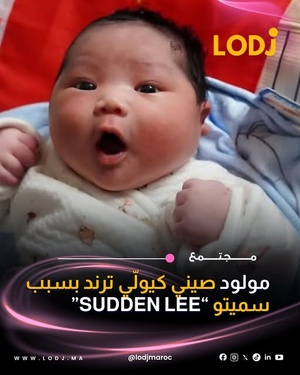 ولادة مبكرة تتحول إلى قصة طريفة بسبب اختيار الاسم