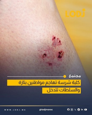 هجوم كلبة على مواطنين يثير القلق بمدينة تازة