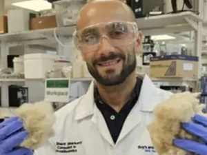 علماء “كينغز لندن” يطورون مادة حيوية من صوف الأغنام لإعادة بناء العظام