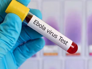 شفاء مريض من إيبولا في ألمانيا يسلّط الضوء على تطور العلاجات والبروتوكولات الطبية شفاء مريض من إيبولا في ألمانيا يسلّط الضوء على تطور العلاجات والبروتوكولات الطبية