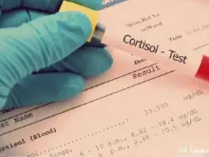الكورتيزول.. هرمون لا ينبغي محاربته بل فهمه