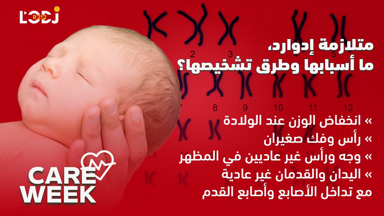 Care Week : رُضَّع يموتون بعد أسبوعٍ واحد، متلازمة إدوارد، ما أسبابها وطرق تشخيصها ؟