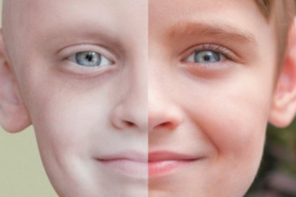 لأول مرة معالجة السرطان بالنووي لأول مرة معالجة السرطان بالنووي