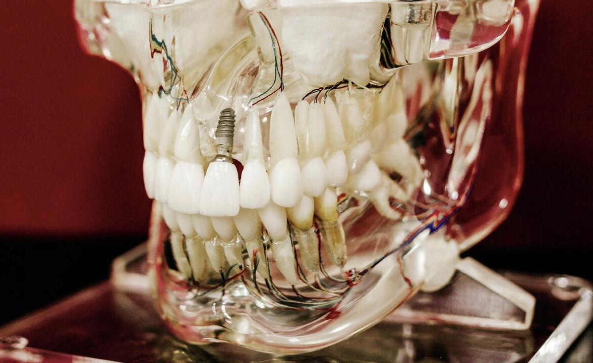 علماء يكشفون عن دواء يعيد نمو الأسنان بعد تكسرها أو تلفها