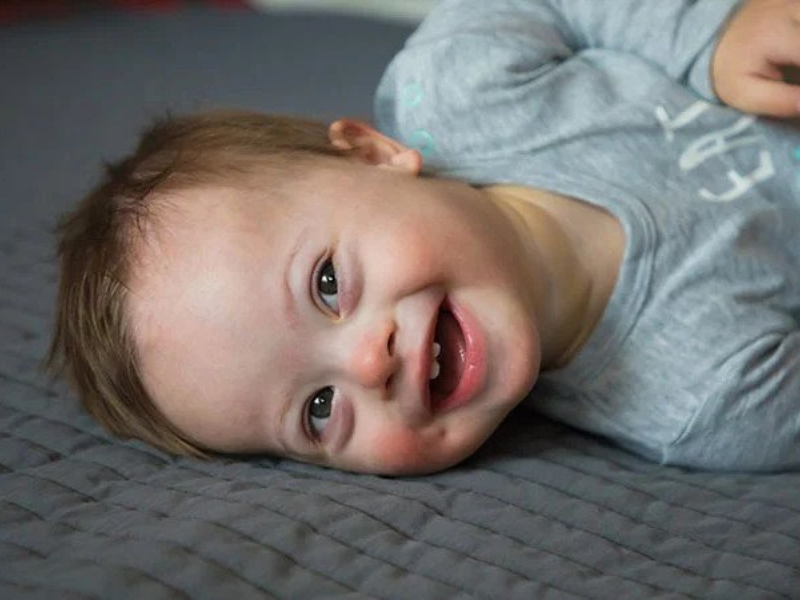 متلازمة داون: التحديات والتقدم في العلاج والدعم متلازمة داون: التحديات والتقدم في العلاج والدعم