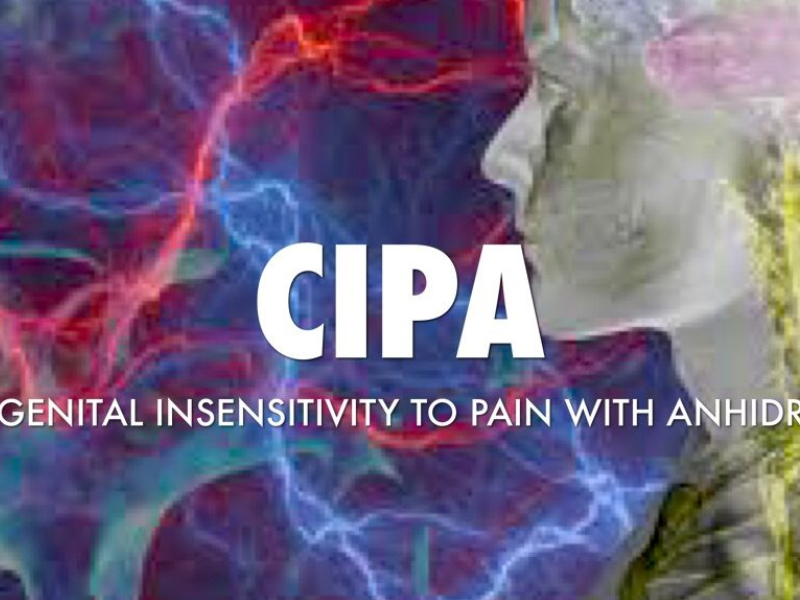 "سيبا" : متلازمة نادرة تمنع الشعور بالألم والبكاء "سيبا" : متلازمة نادرة تمنع الشعور بالألم والبكاء