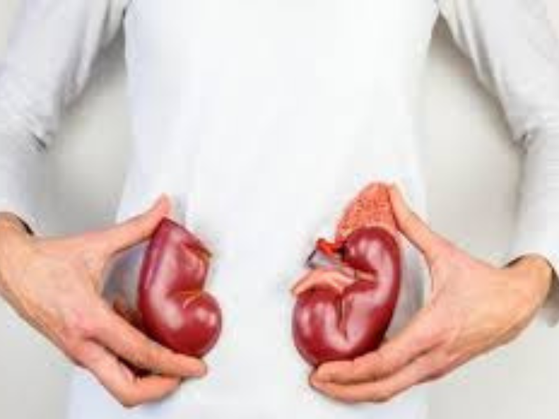 جمعية «كلي» تحتفل باليوم العالمي للكلى تحت شعار "الكشف المبكر لحماية صحة الكلى" جمعية «كلي» تحتفل باليوم العالمي للكلى تحت شعار "الكشف المبكر لحماية صحة الكلى"