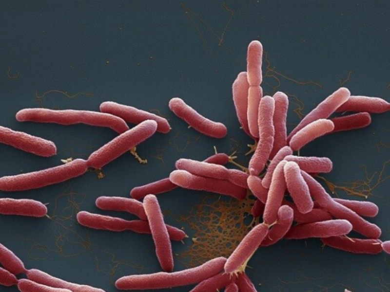 مرض "المليودوسيس": تحدٍ صحي متزايد في المناطق الاستوائية وشبه الاستوائية مرض "المليودوسيس": تحدٍ صحي متزايد في المناطق الاستوائية وشبه الاستوائية