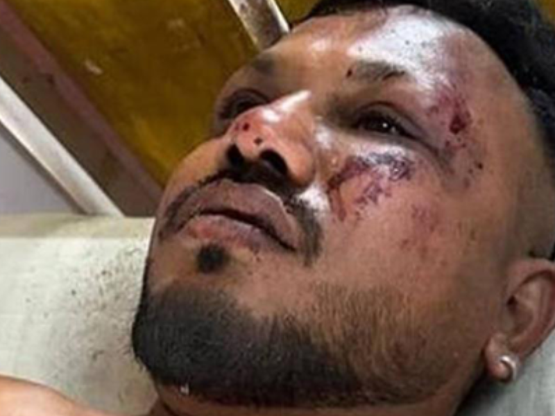الناجي الوحيد من حادث تحطم طائرة «إير إنديا»: قصة صمود وسط الحطام