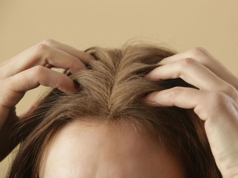 أحدث التقنيات لعلاج مشاكل فروة الرأس: ابتكارات تكنولوجية تعزز صحة الشعر أحدث التقنيات لعلاج مشاكل فروة الرأس: ابتكارات تكنولوجية تعزز صحة الشعر