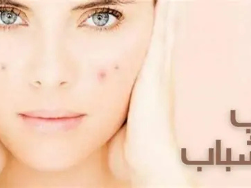 علاج حب الشباب بالثوم في يوم واحد: حقيقة أم خرافة؟