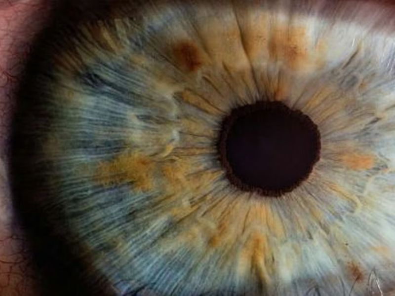 دراسة كندية: فحص العين قد يكشف خطر أمراض القلب وسرعة الشيخوخة دراسة كندية: فحص العين قد يكشف خطر أمراض القلب وسرعة الشيخوخة