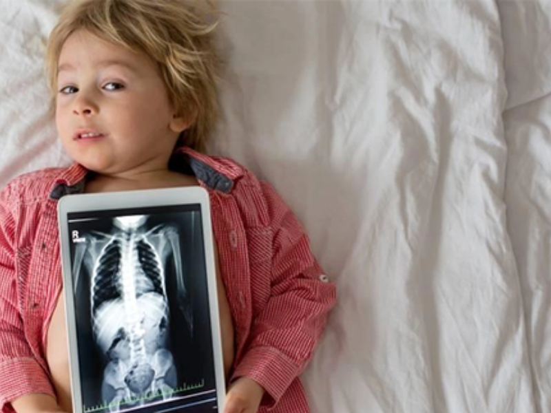 نيوزيلندا: جراحون ينقذون طفلاً ابتلع 100 مغناطيس اشتراها عبر الإنترنت