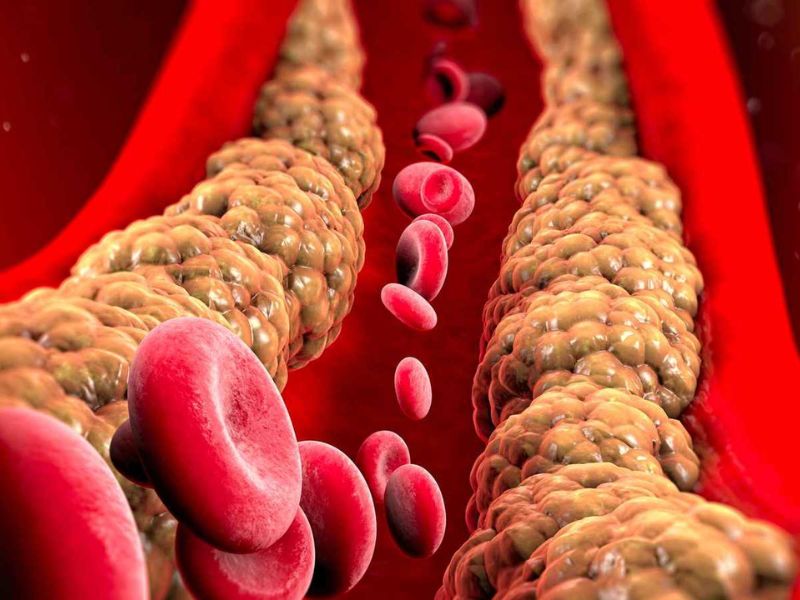 نصائح مثبتة علميًا لتقليل الكوليسترول وتحسين القلب بلا أدوية