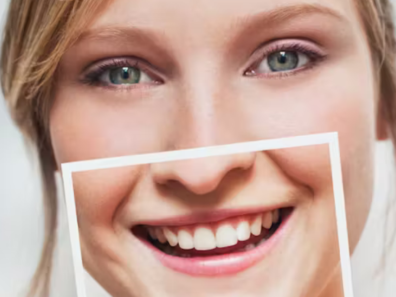 بيكربونات الصوديوم وتبييض الأسنان: بين الفوائد والمخاطر