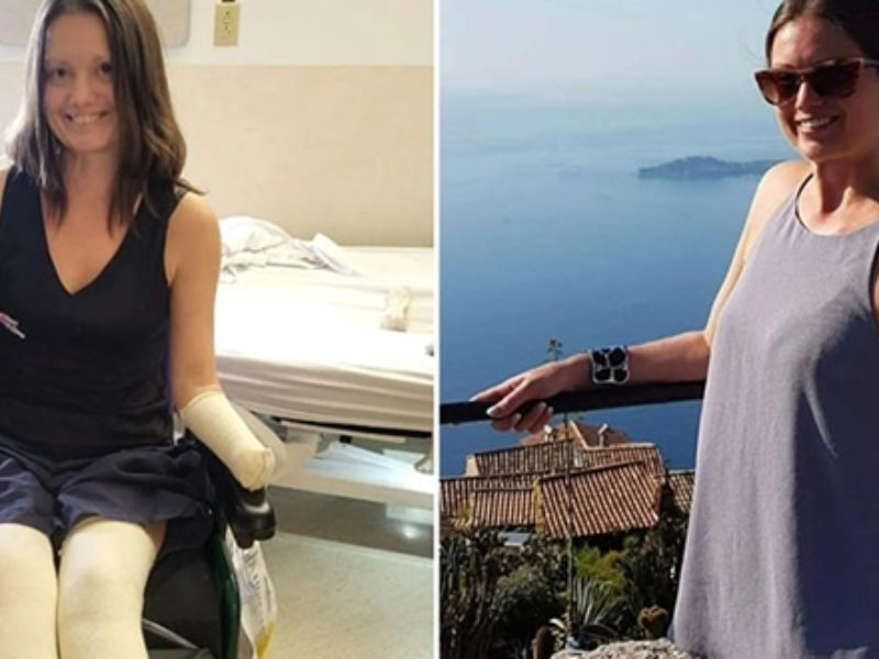 من ألم بسيط إلى مأساة صحية… عدوى نادرة تبتر أطراف امرأة كندية وتنقذ حياتها