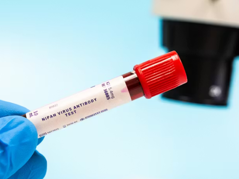 فيروس نيباه: تهديد صحي عالمي بلا لقاح أو علاج