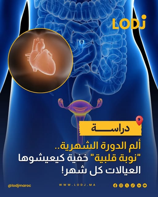 دراسة : آلام الدورة الشهرية قد تكون بقوة أزمة قلبية